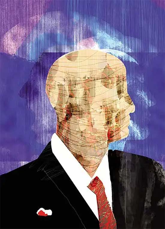 El síndrome de la Habana parece una enfermedad psicosomática (pero eso no quiere decir que los síntomas no sean reales)